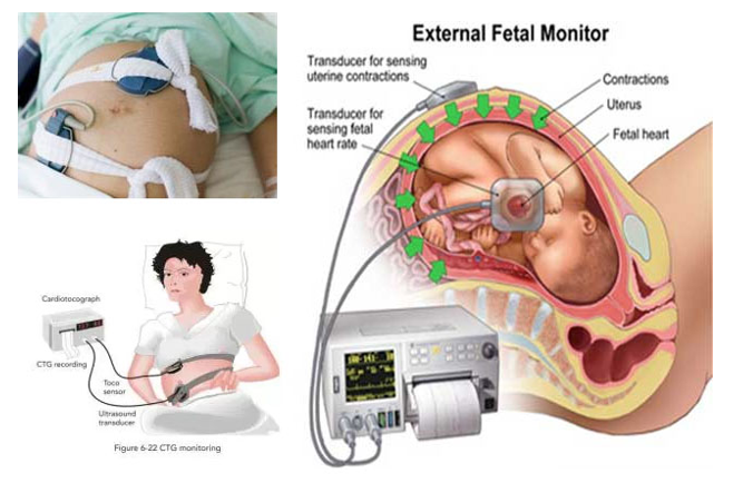 MONITOR SẢN KHOA