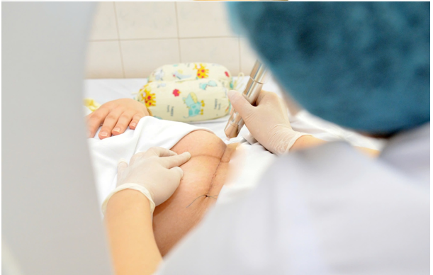 ỨNG DỤNG TIA PLASMA