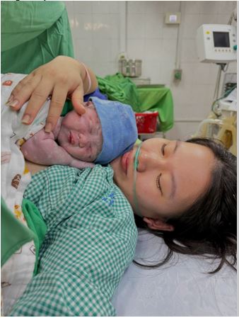 LỢI ÍCH CỦA PHƯƠNG PHÁP DA KỀ DA NGAY SAU MỔ LẤY THAI